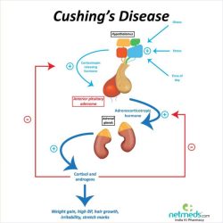 Cushing syndrome approach