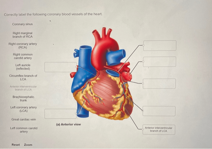 Correctly label the following coronary blood vessels of the heart